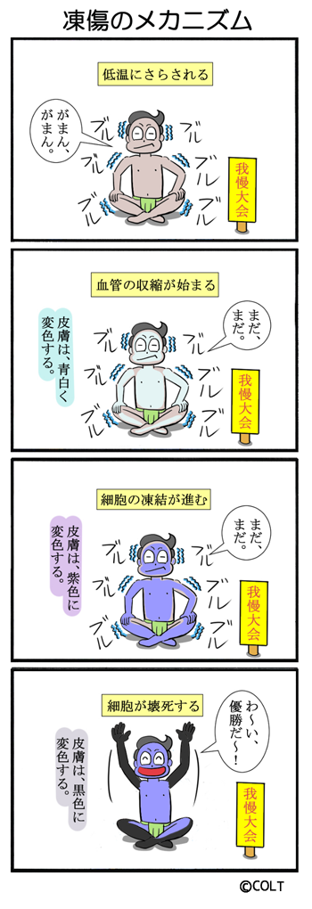 No 176 凍傷のメカニズム Coltマンガチャンネル